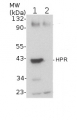 HPR | Hydroxypyruvate reductase (peroxisomal matrix marker)